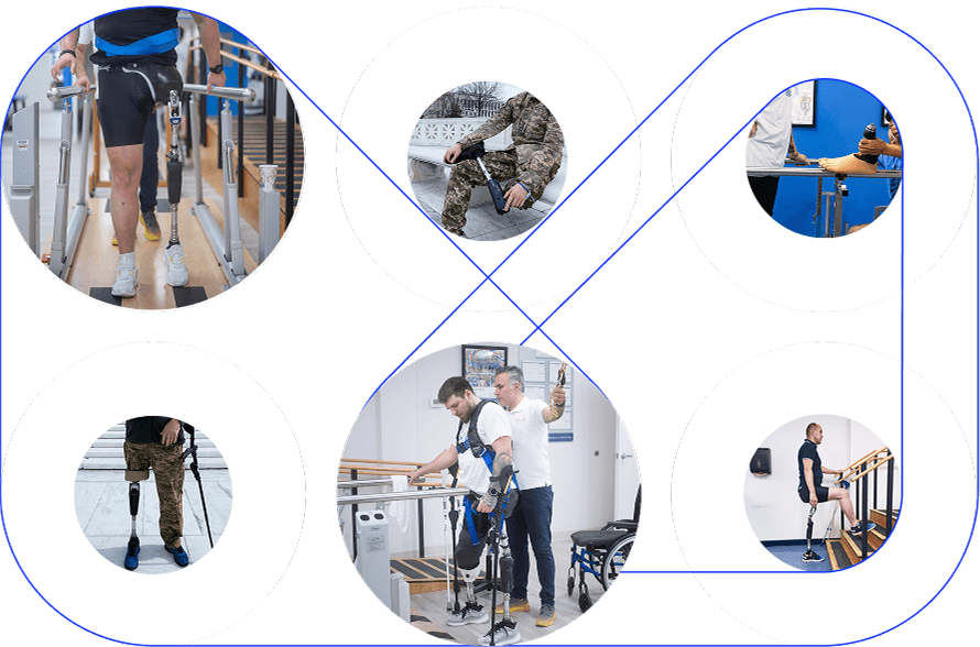 Protetyka kończyn dolnych