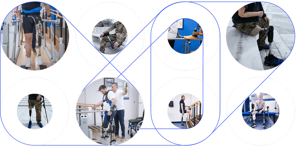 Protetyka kończyn dolnych