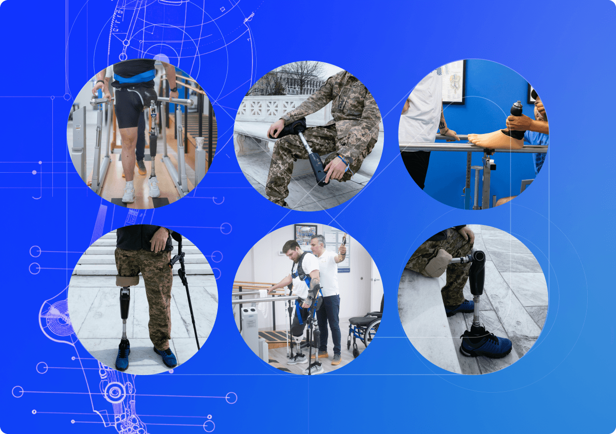 Protetyka kończyn dolnych